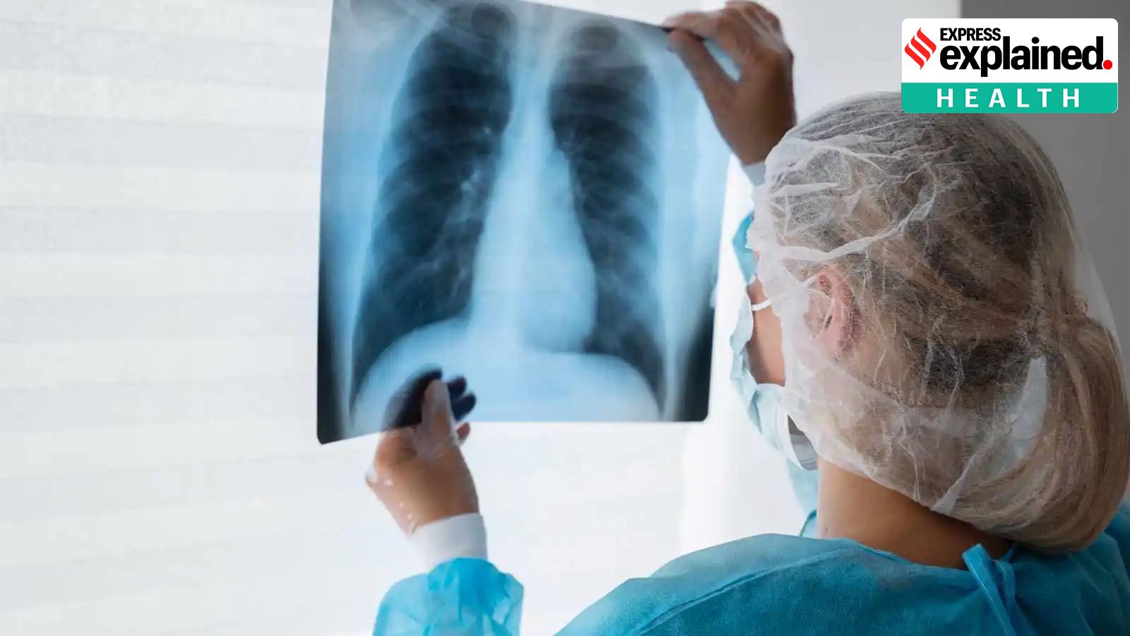 Gates MRI, SII tie-up for manufacture TB vaccine candidate | Pune News